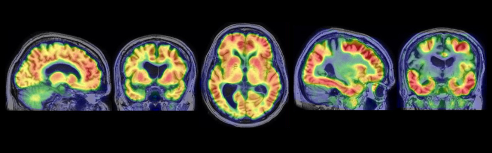 brain scans